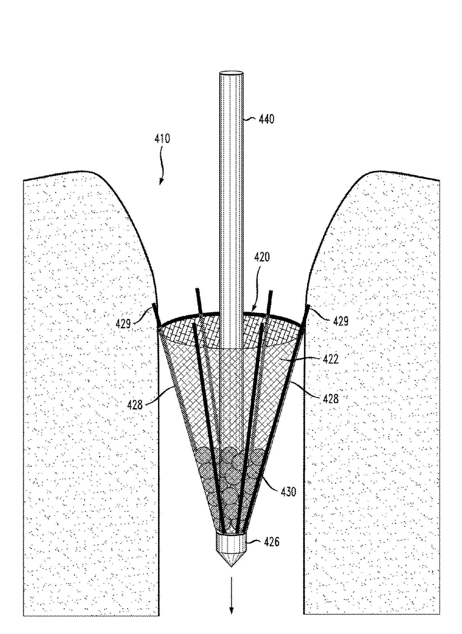 Illustration from the patent application for the mesh filter that is designed to block sand boils.